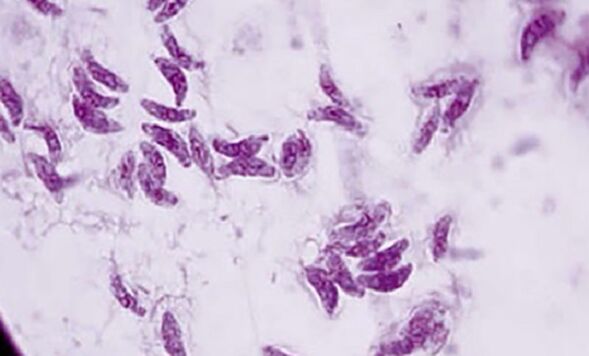protozoan parasitic toxoplasma gondii is the pathogen of toxoplasmosis