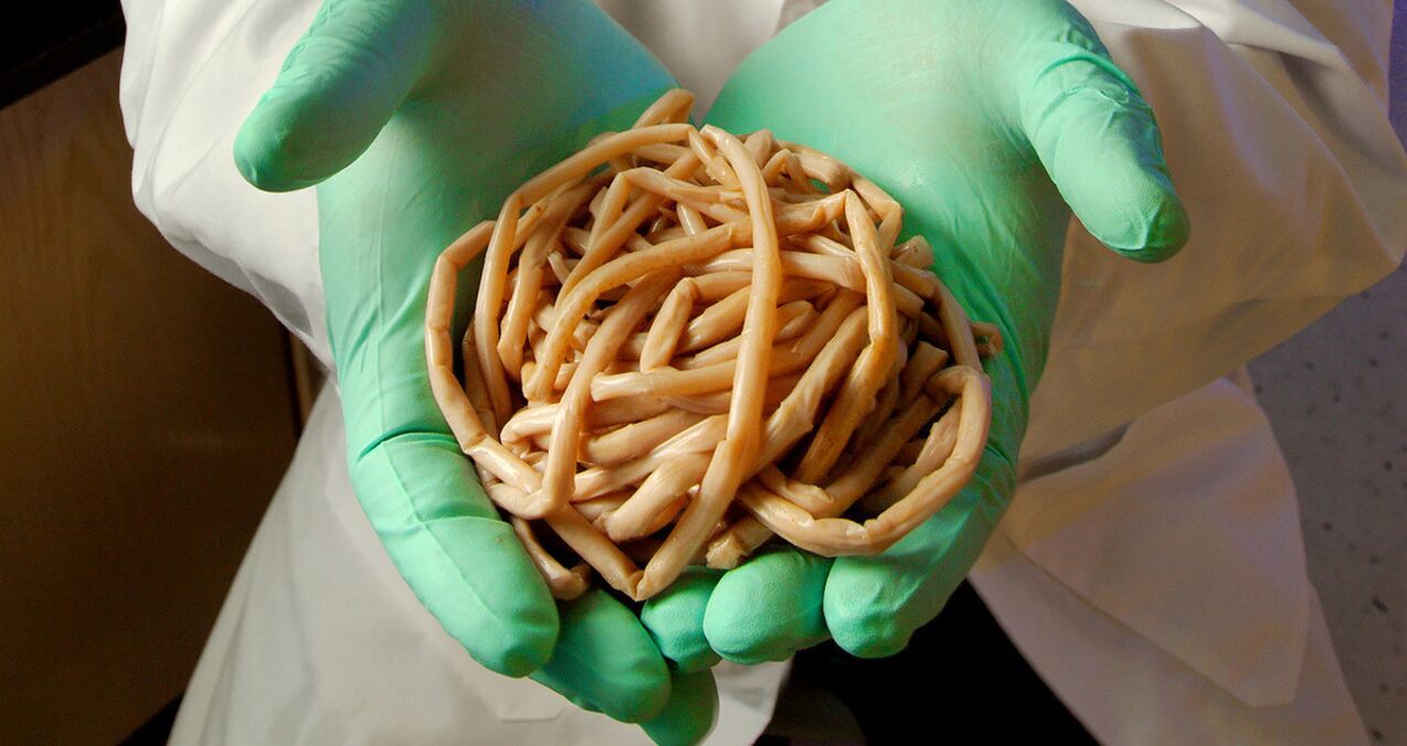Worms (intestinal worms) in the hands of a doctor