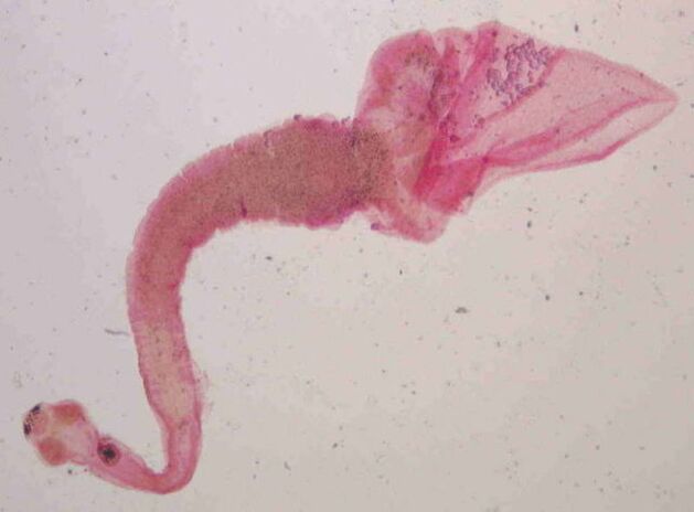 swine tapeworm from the human body